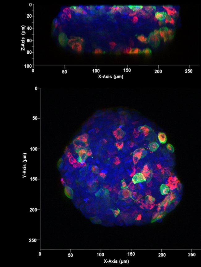 A549 spheroid mounted with Prolong Glass and imaged with confocal microscope with lateral and axial projections